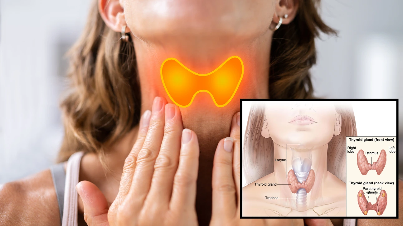 Thyroid Surgery