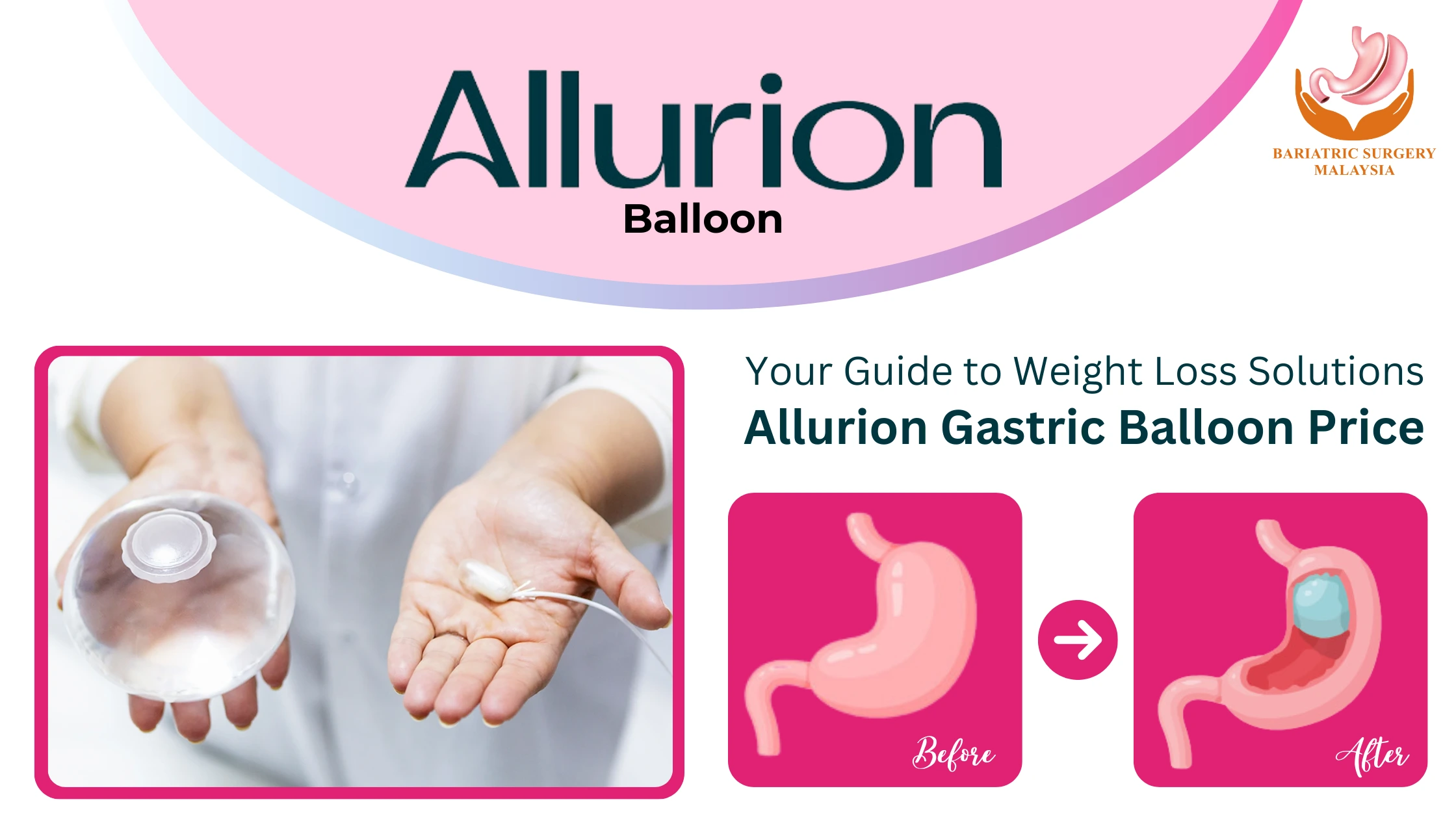 Allurion Gastric Balloon Price