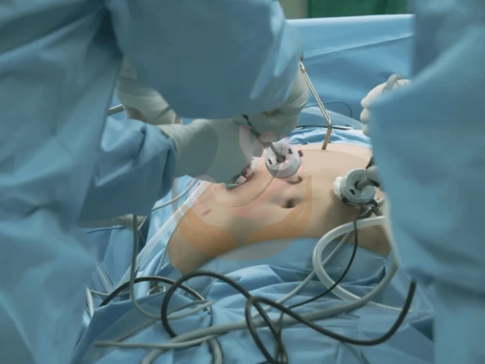 bariatric-procedures