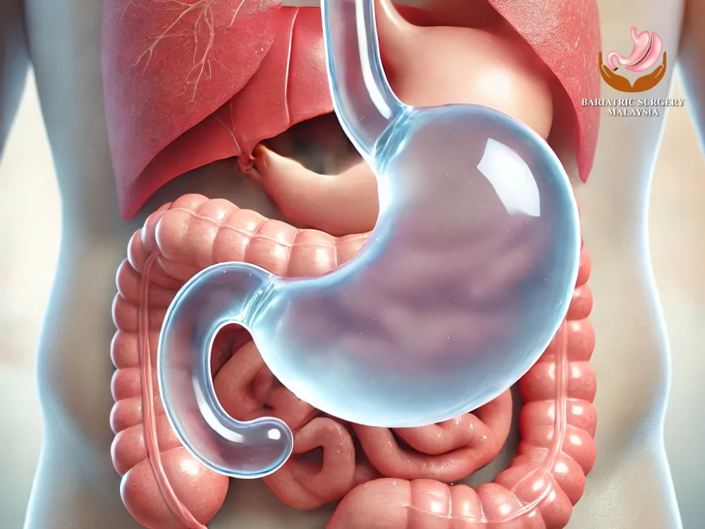 gastric-balloon-cost