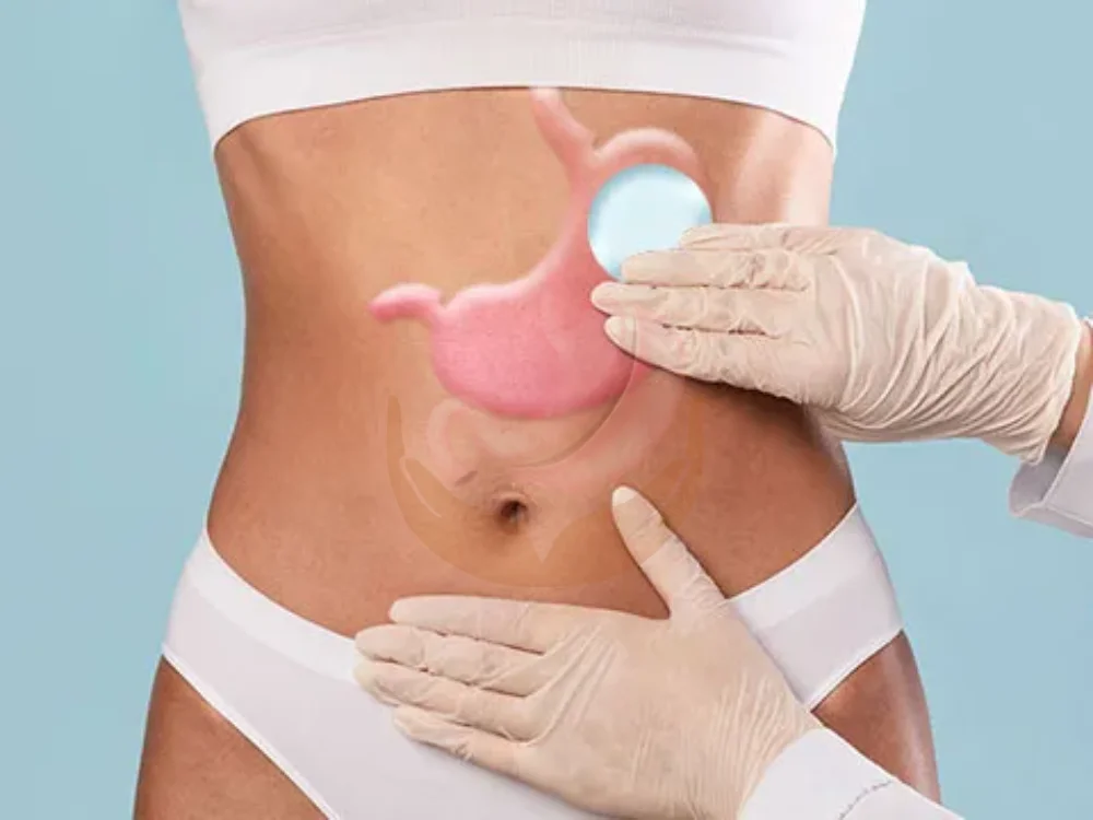 gastric-balloon-near-me