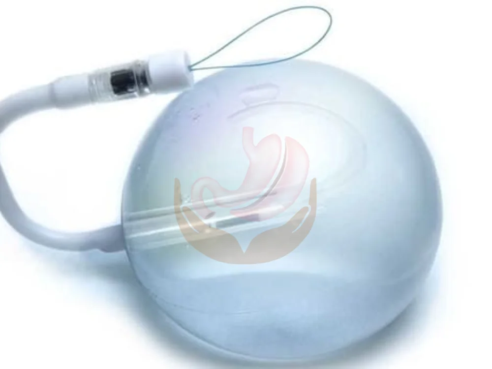 gastric-balloon-surgery