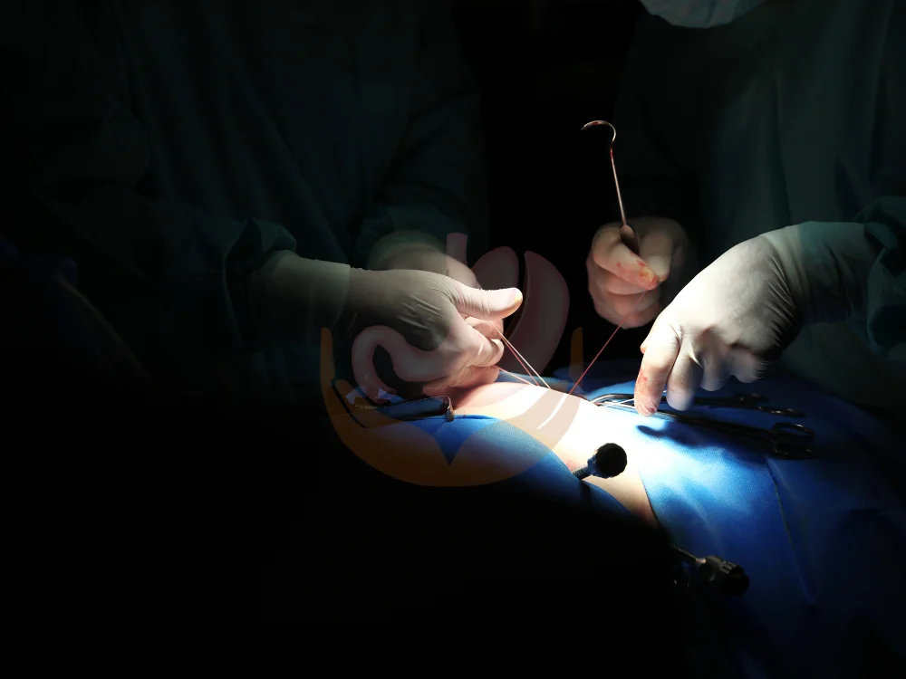 stomach-operation