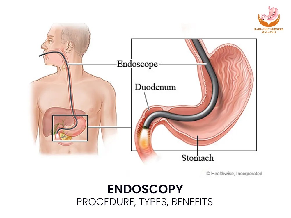 endoscopy-procedure-benefits-1