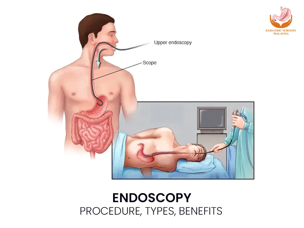 endoscopy-procedure-benefits