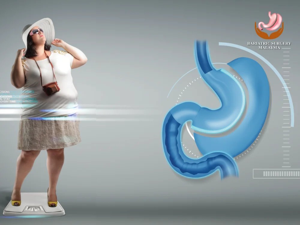 bariatric-center-near-me