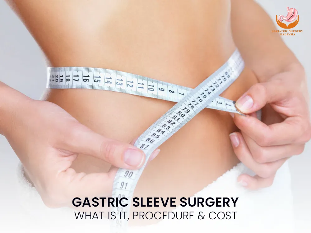 sleeve-surgery-gastric