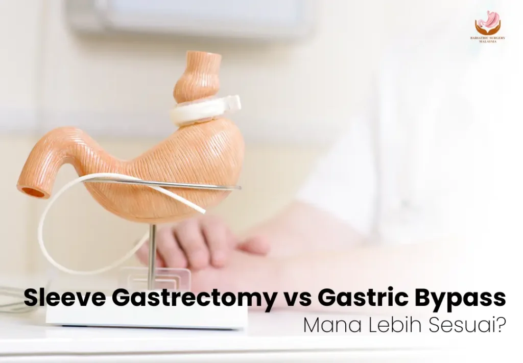 sleeve-gastrectomy- gastric-bypass
