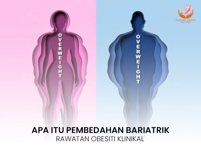 Apa Itu Pembedahan Bariatrik: Panduan Lengkap Rawatan Obesiti Klinikal