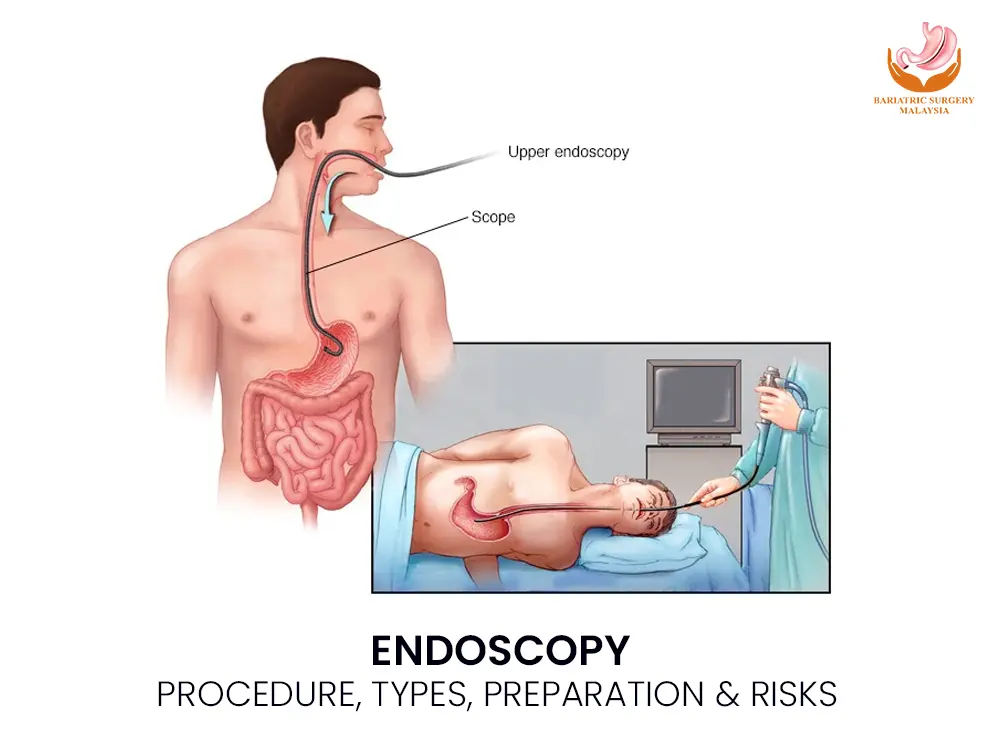 endoscopy-medical-guide