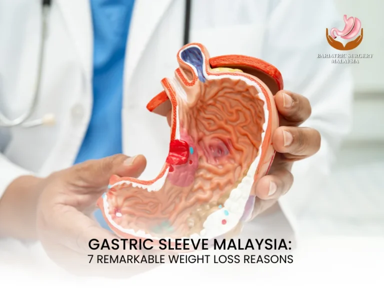 7 Remarkable Reasons Why Gastric Sleeve Malaysia Is a Life-Changing Weight Loss Solution