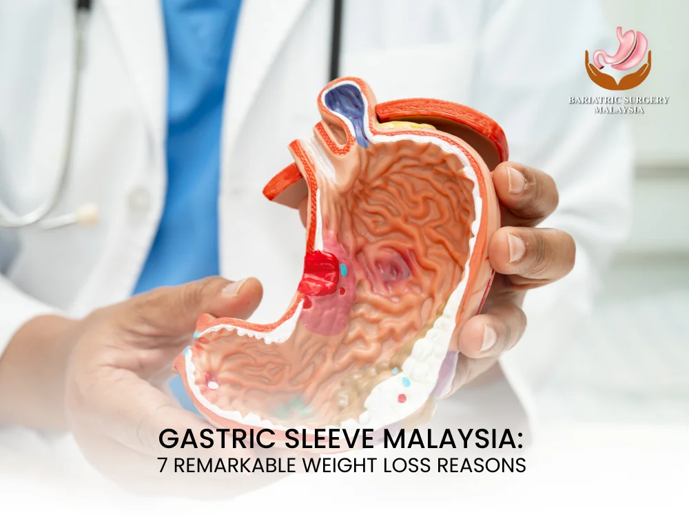 gastric-sleeve-malaysia