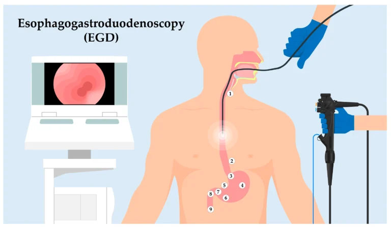 gastroent 15 00001 g001