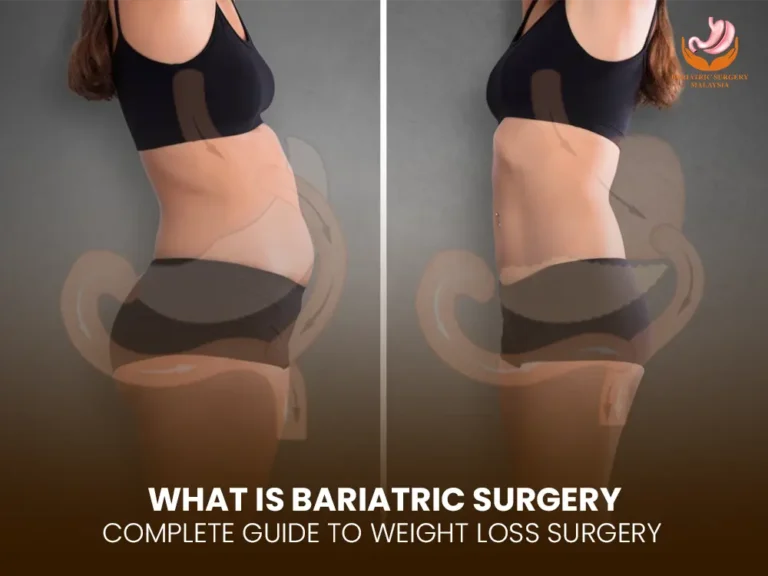 What Is Bariatric Surgery? A Complete Guide to Weight Loss Surgery
