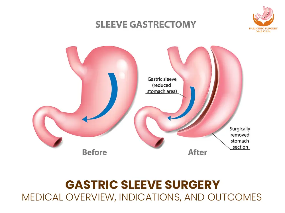 gastric-sleeve-surgery-clinic