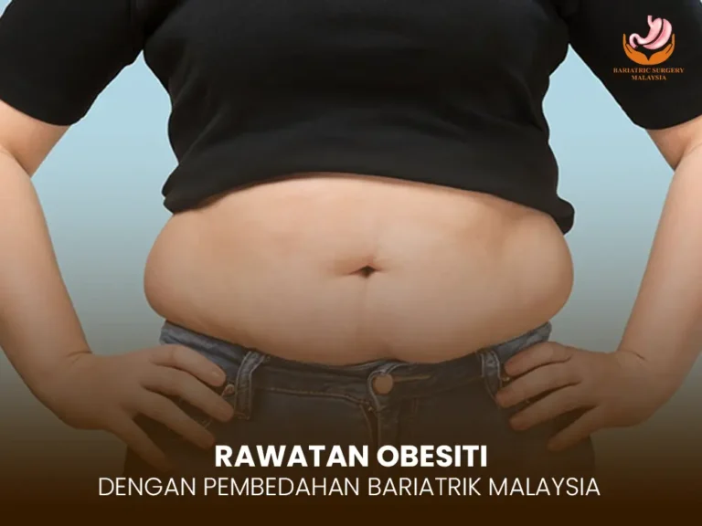 Rawatan Obesiti Dengan Pembedahan Bariatrik: Cara Turunkan Berat Badan Dengan Selamat