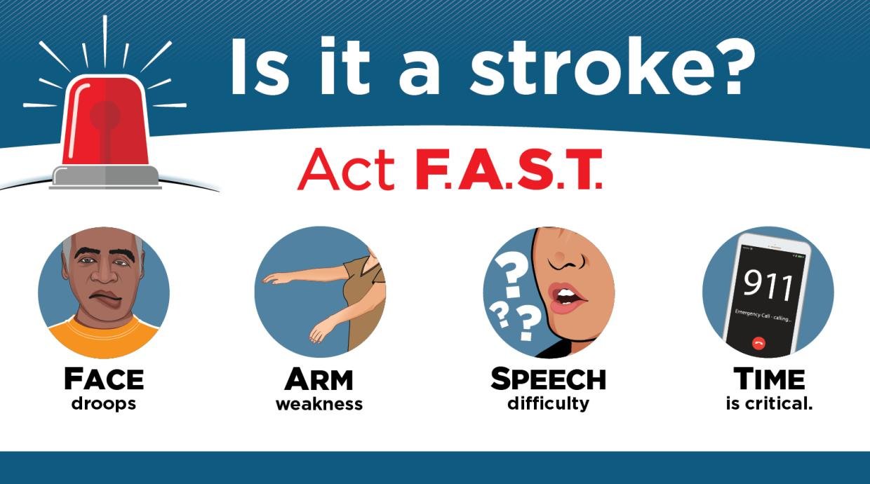 Tanda-Tanda Sebelum Serangan Stroke
