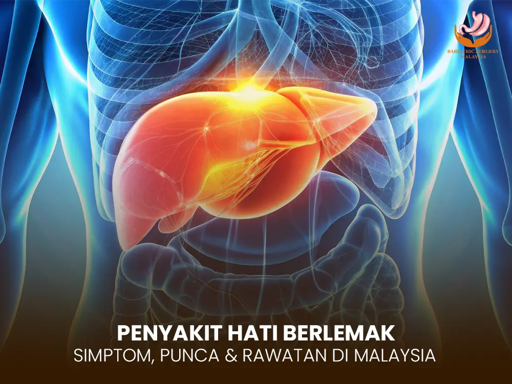 hati-berlemak-fatty-liver