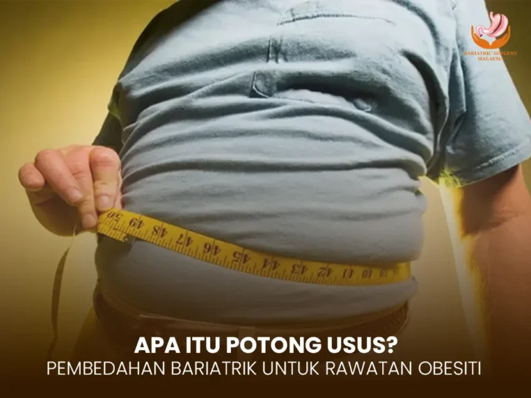 Apa Itu Potong Usus? Turun Berat Badan Dengan Pembedahan Bariatrik Selamat