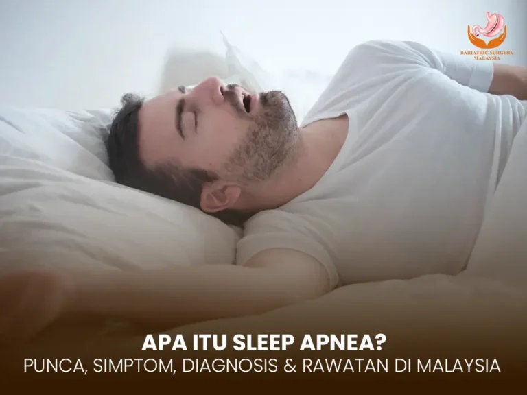 Sleep Apnea: Punca, Simptom, Diagnosis & Rawatan di Malaysia