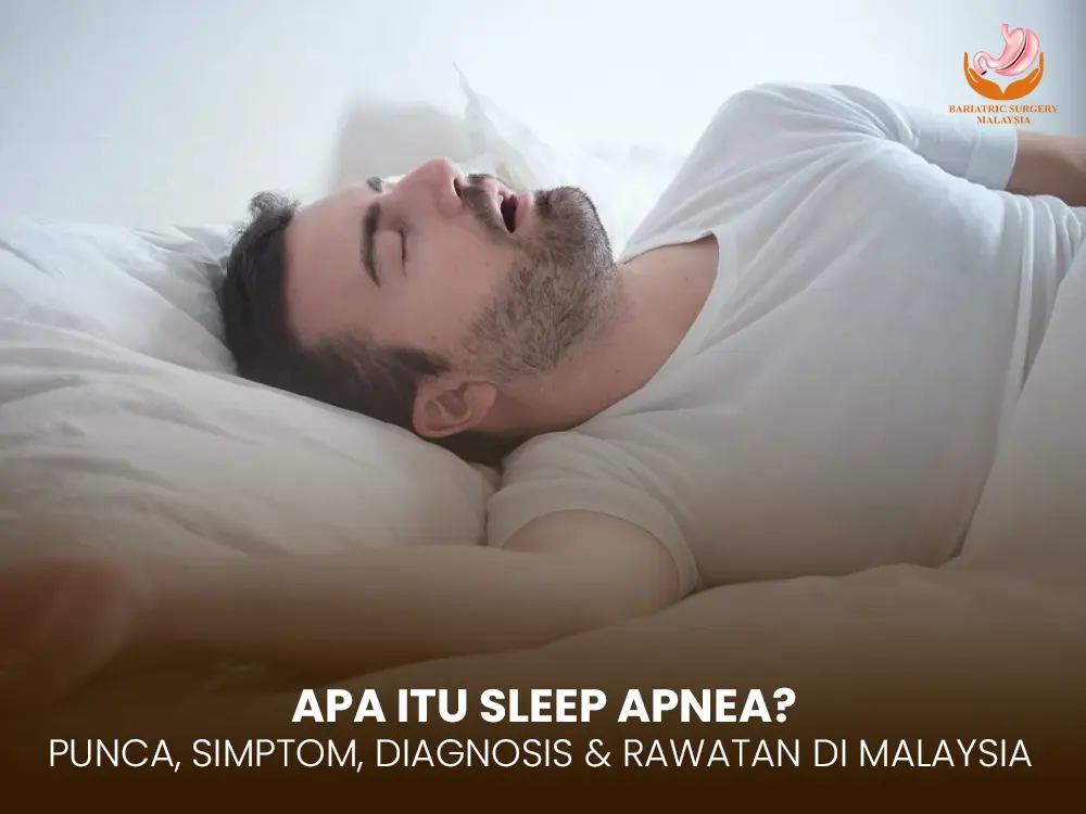 sleep-apnea-malaysia