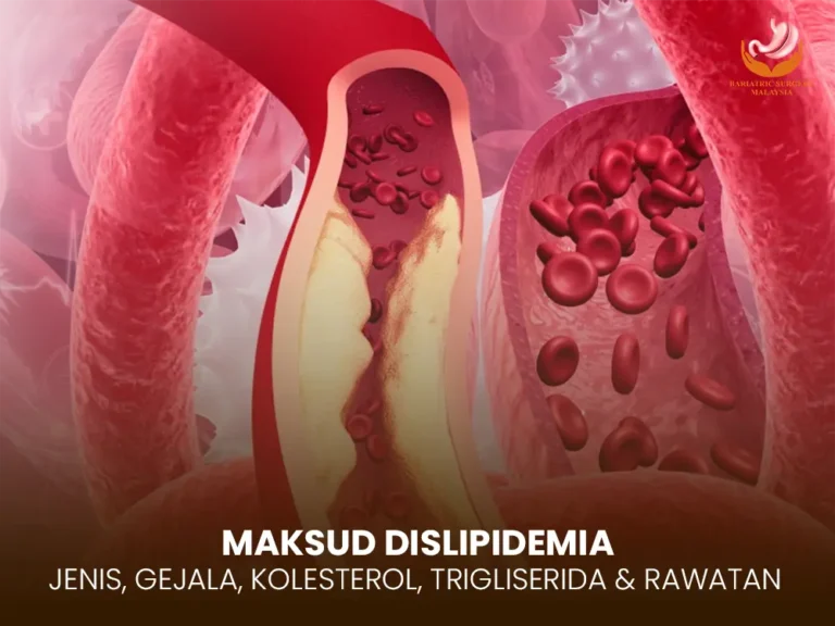Dislipidemia: Maksud, Jenis, Gejala, Kolesterol, Trigliserida & Rawatan