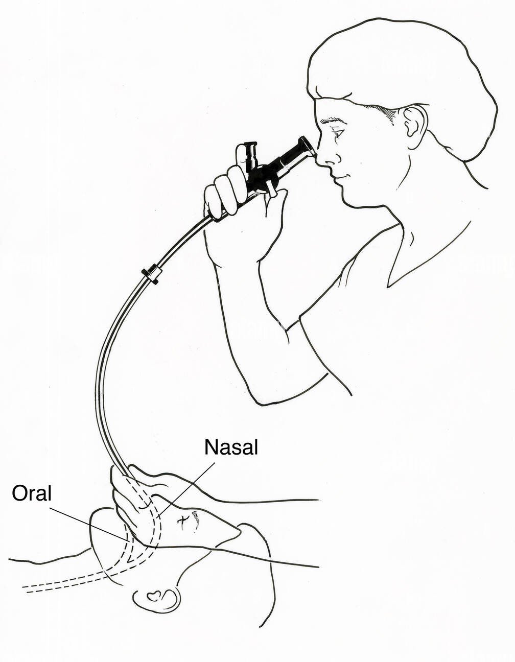 endoscopy digestive health