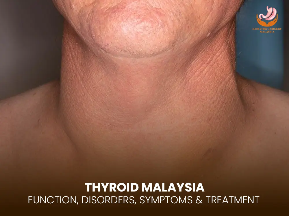 thyroid-malaysia