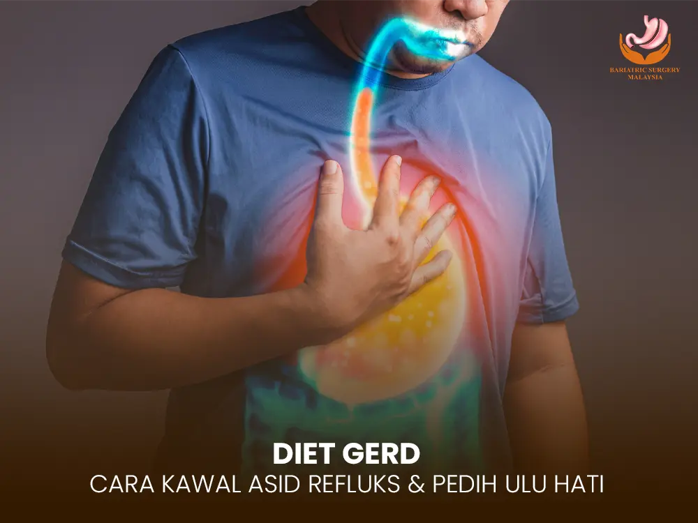 diet gerd
