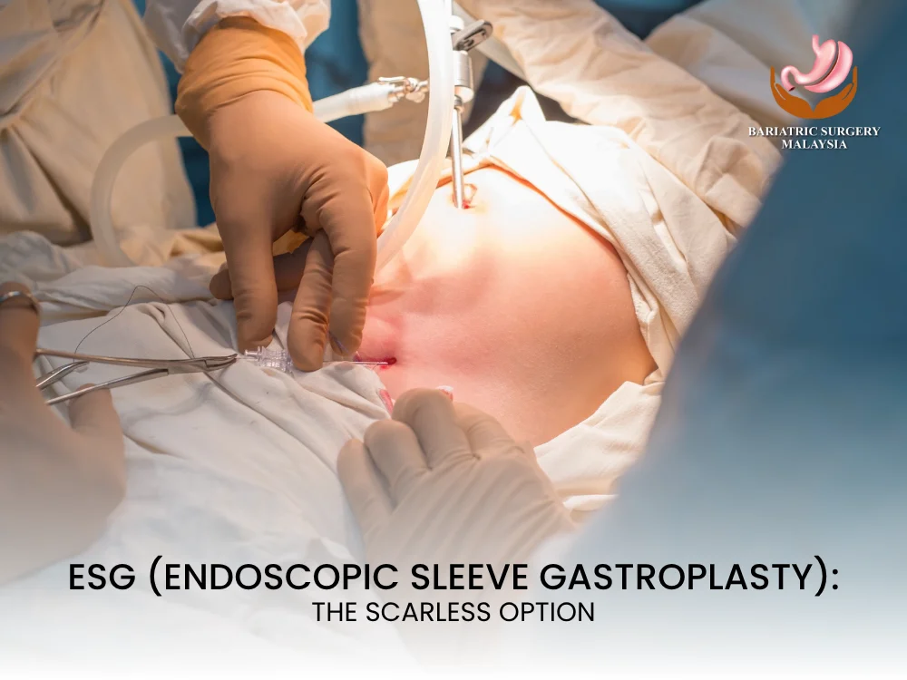 esg-scarless-bariatric-malaysia