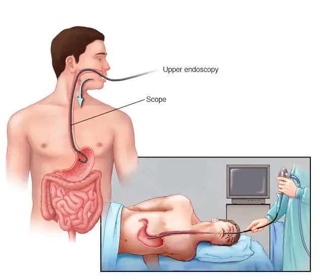 endoscopy3
