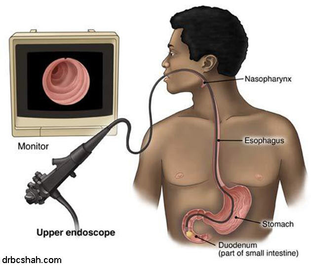 endoscopy4